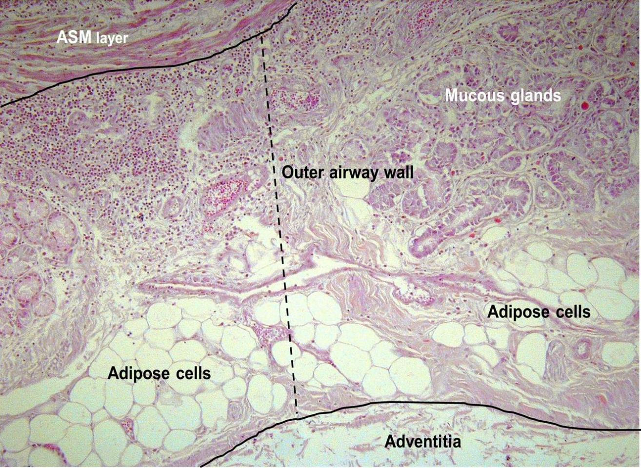 The outer airway wall, between the airway smooth muscle (ASM) layer and the airway adventitia (dashed line) showing adipose tissue and mucous glands.
