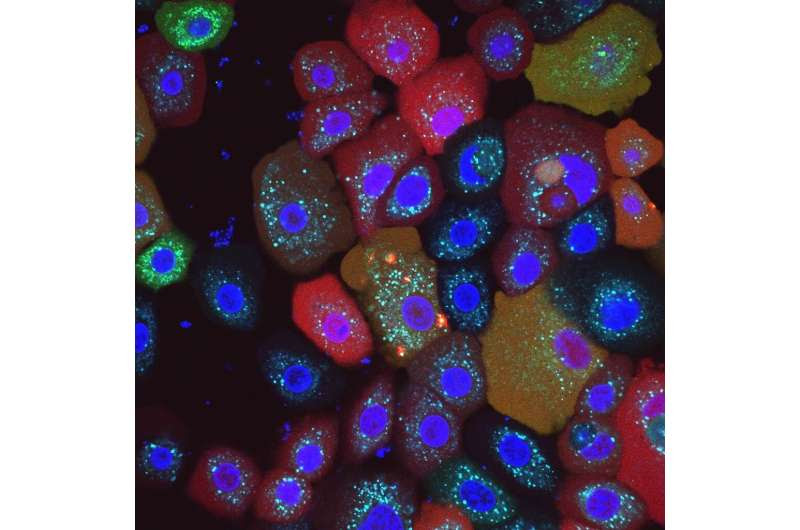 New intracellular 'smoke detector' discovered