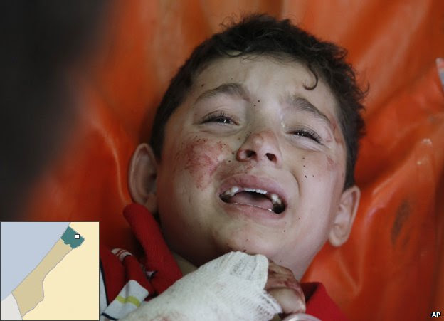 A Palestinian child, wounded in a strike on a compound housing a UN school in Beit Hanoun, in the northern Gaza, cries at the emergency room of the Kamal Adwan hospital in Beit Lahiya, Thursday 24 July 2014