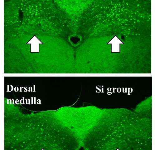 Hydrogen generated by Si-based agent attenuates inflammation in ulcerative colitis mouse model