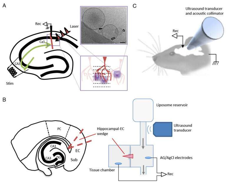 Research offers new hope for people living with seizures