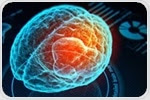 New device uses electromagnetic waves to reverse Alzheimer’s