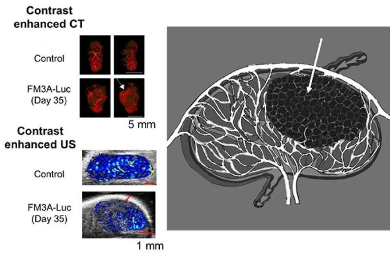 Cancer cells impair blood flow in metastatic lymph nodes