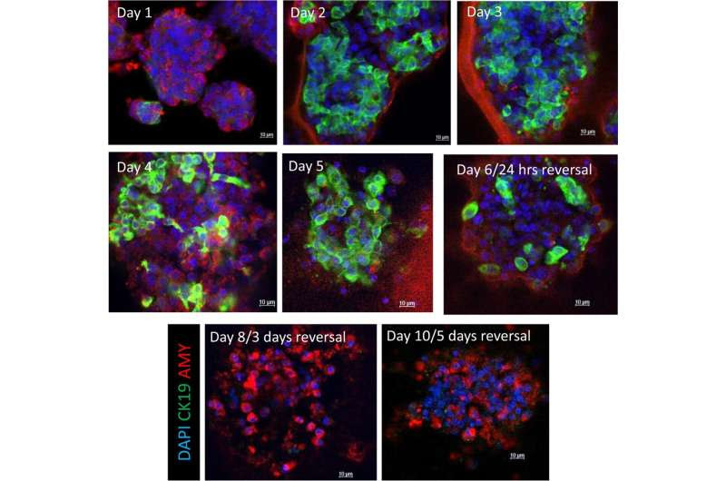 Two drugs reverse key pancreatic cancer step in the lab