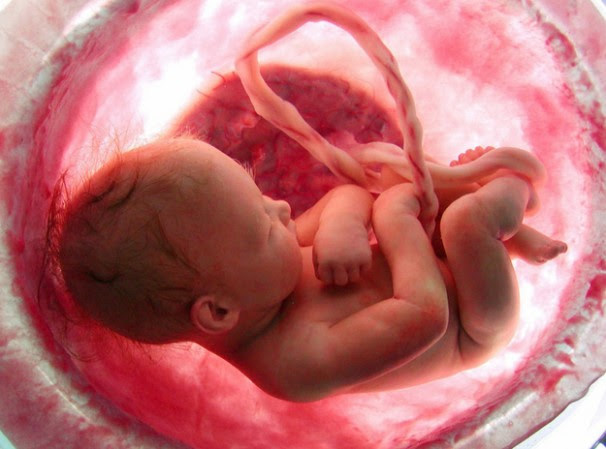 unborn ultrasound