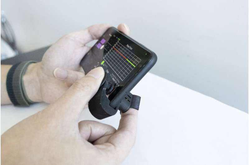 Super low-cost smartphone attachment brings blood pressure monitoring to your fingertips