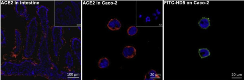 Co-location of ACE2 and HD5 in human intestinal villus and enterocytes.