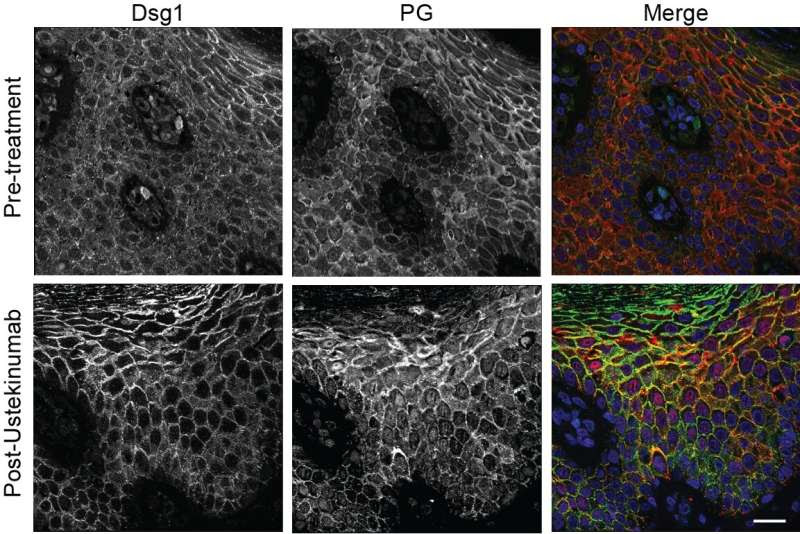 Uncovering cellular mechanisms of genetic skin diseases