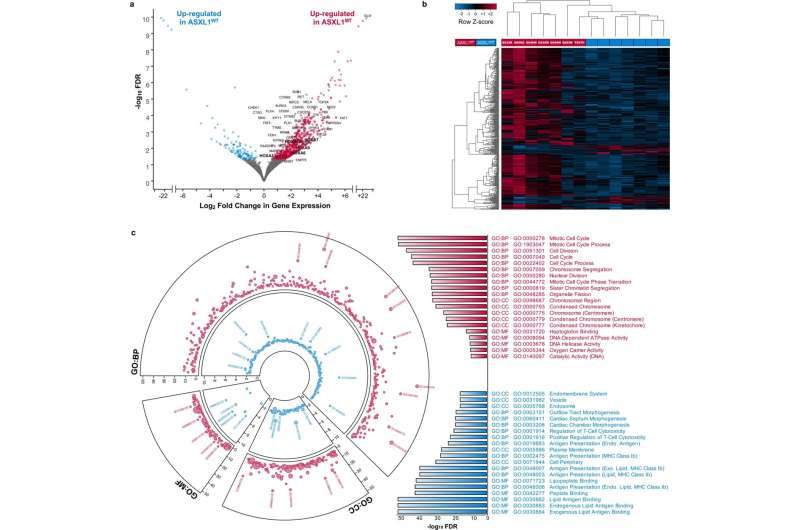 Research discovery in bone marrow cancer points to potential drug targets