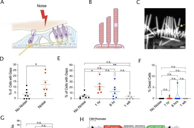 Scientists discover repair process that fixes damaged hearing cells