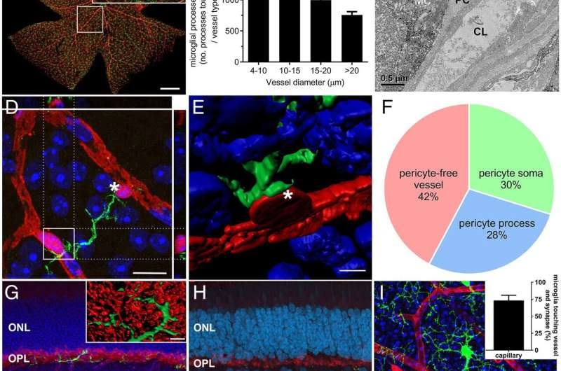 Retinal immune cells may hold key to preventing diabetes-related vision loss