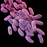 Carbapenem-resistant Enterobacteriaceae (CRE)