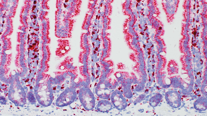 Mouse Small Intestine