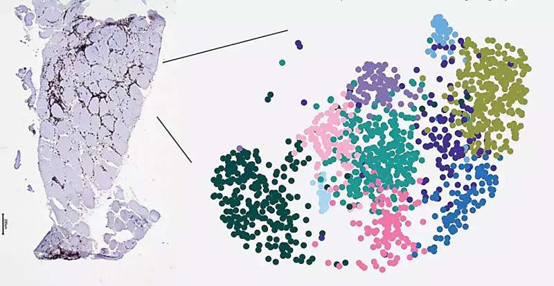 Persistent T cells identified in the muscle of patients with idiopathic inflammatory myopathies