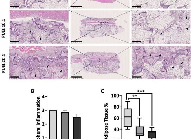 Soft tissue regeneration in a cell-free scaffold microenvironment