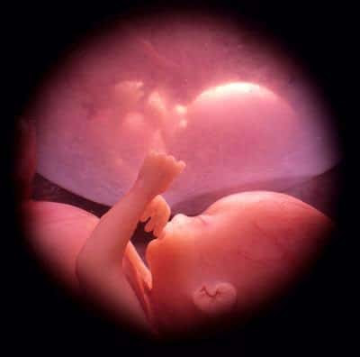 Dos tercios de las
muertes intrauterinas se podrían evitar