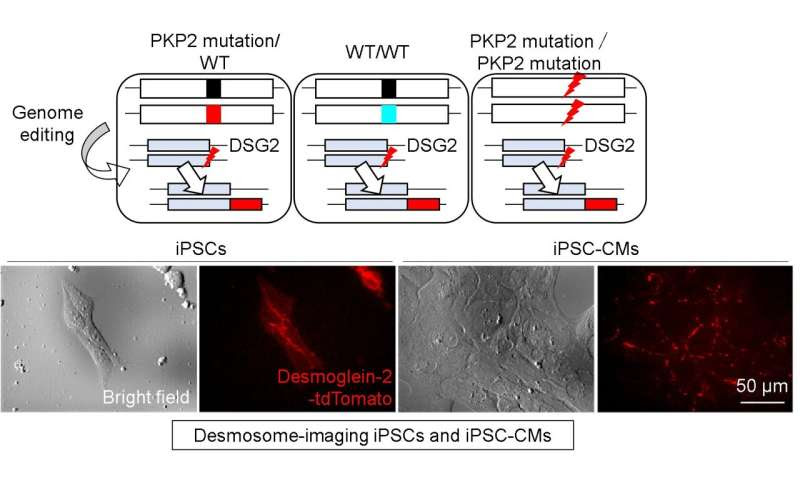 Patient-derived heart cells mimic disease in vitro