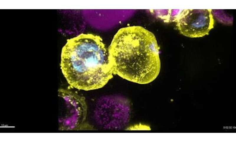 New light shone on inflammatory cell death regulator