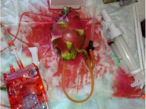TEACG-UCSF-abortion-training-uses-pitaya-of-dragonfruit-to-simulate-abortion-complications