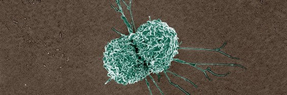 An immune cell