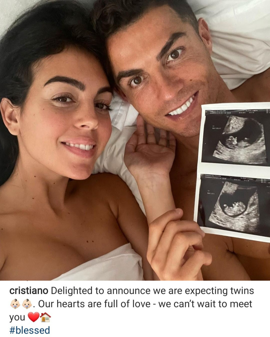 Cristiano Ronaldo and Georgina Rodriguez are expecting twins