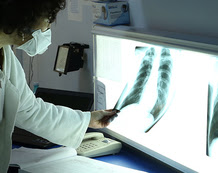 Doctor examining x-rays