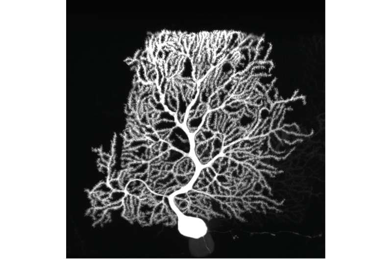 New proteomic technique reveals secrets of dendrite development