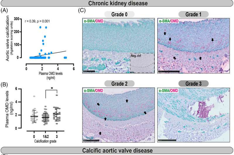 Osteomodulin is a novel biomarker of vascular calcification