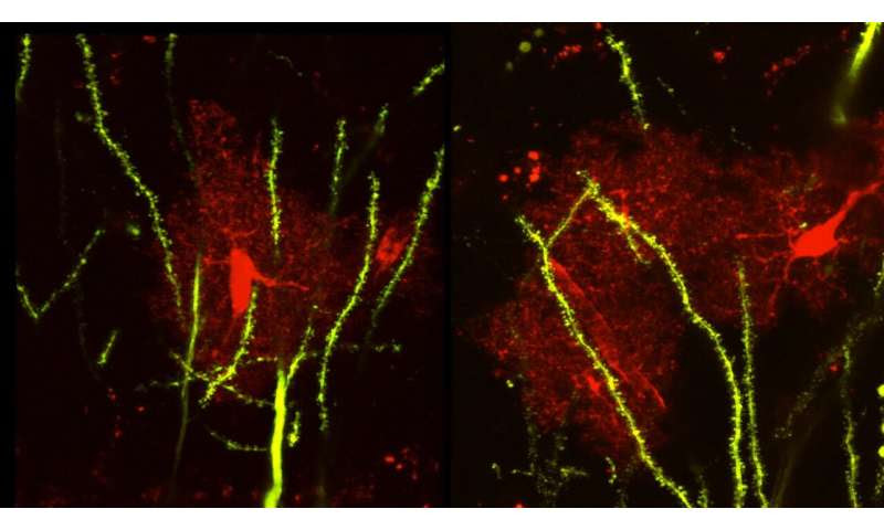 Brain protein linked to seizures, abnormal social behaviors