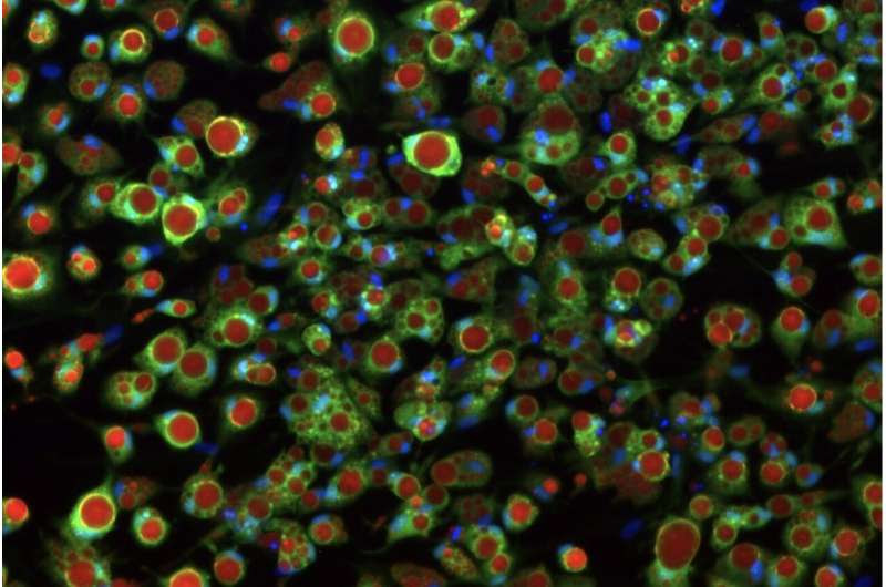 Lab-grown fat cells help scientists understand type 2 diabetes