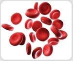 New discovery may offer insight into treating sickle cell anemia and other blood disorders