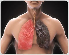 New computer program provides more thorough preparation for diagnosis of lung diseases
