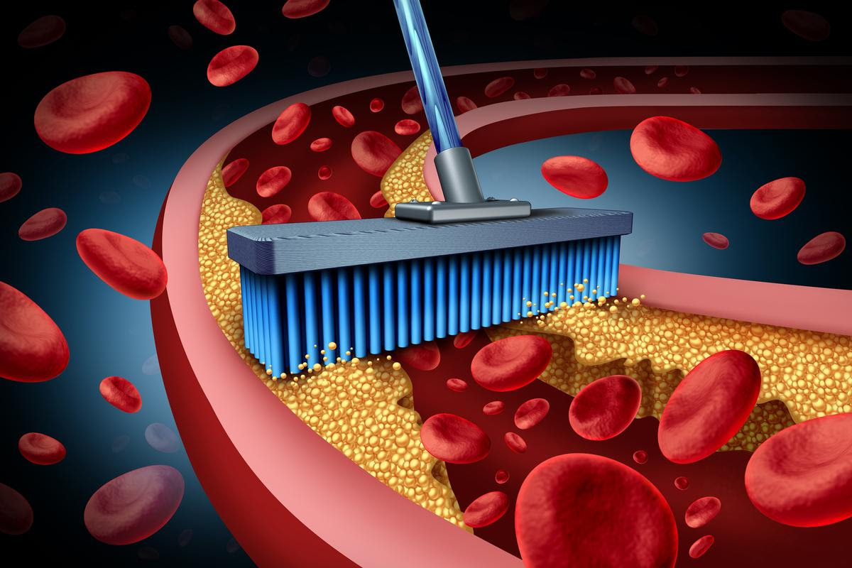 Ramping up a natural cellular cleaning process could help prevent arteries from clogging and causing heart attacks and strokes