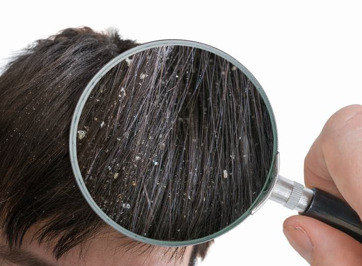 itchy scalp
