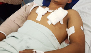 herido1