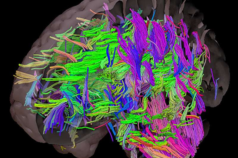 Obesity may exacerbate the effects of Alzheimer's disease, new study shows