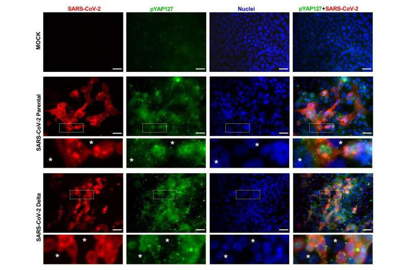 Scientists say eye-disease drug may also help fight COVID