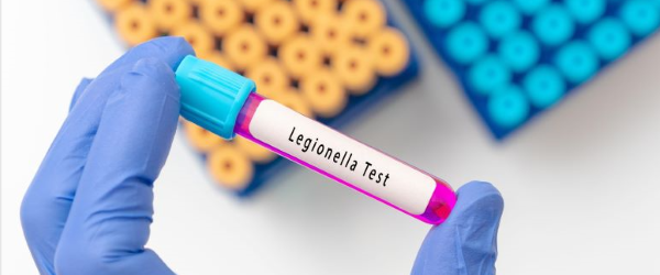 Legionella management: Back to basics