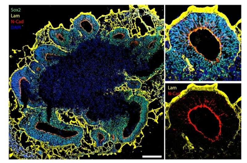 Miniature brain models help understand autism