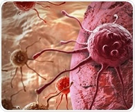 Queen's University Belfast leads new research to better understand biology of prostate cancer