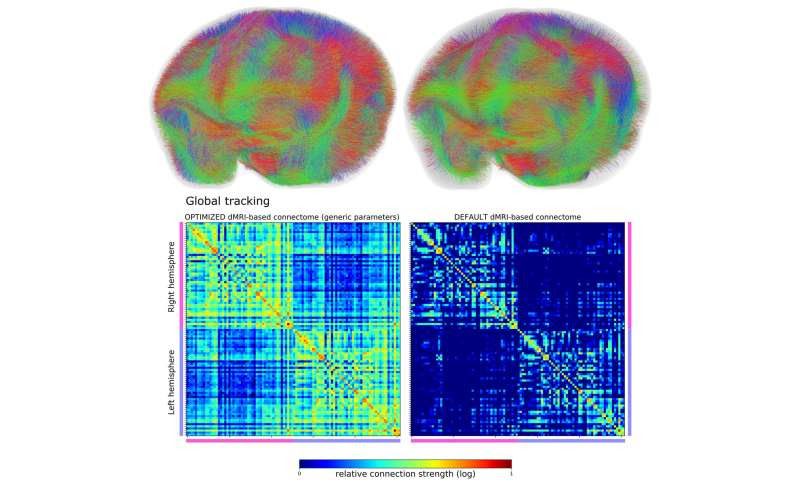 Machine intelligence accelerates research into mapping brains