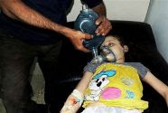 Girl being treated at a field hospital in Arbeen, Syria after chemical weapons attack.