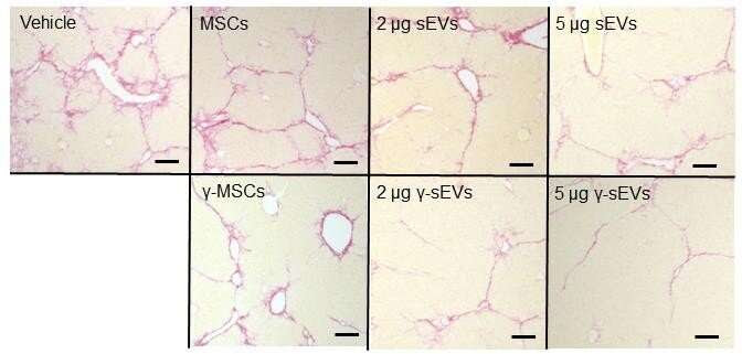 A glimmer of hope: New weapon in the fight against liver diseases