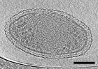 Image_3D_quer This cryo-electron tomography image reveals the internal structure of an ultra-small bacteria cell like never before. The cell has a very dense interior compartment and a complex cell wall. The darker spots at each end of the cell are most likely ribosomes. The image was obtained from a 3-D reconstruction. The scale bar is 100 nanometers. (Credit: Berkeley Lab)