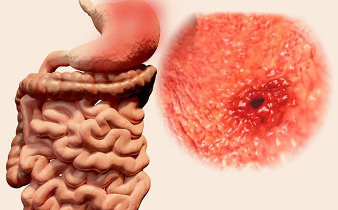 7 triệu chứng ung thư sớm không gây đau: Chỉ cần có 1 triệu chứng là bạn phải đi khám ngay 7 triệu chứng ung thư sớm không gây đau: Chỉ cần có 1 triệu chứng là bạn phải đi khám ngay
