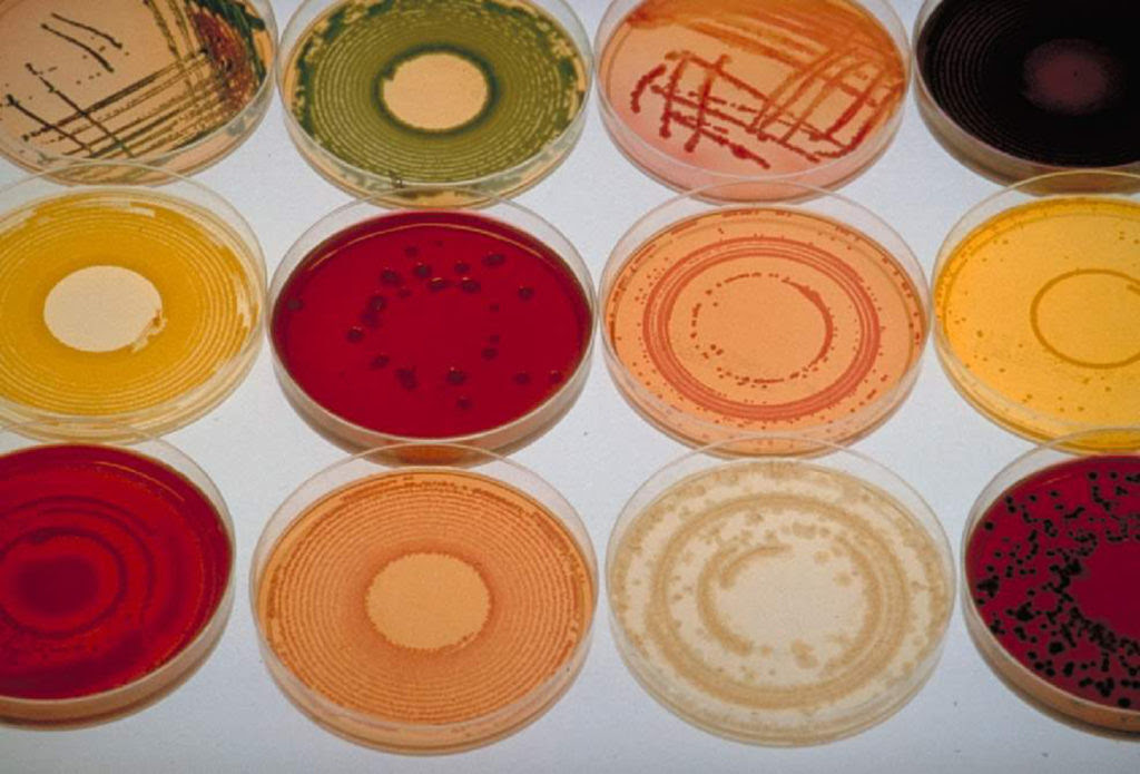 A variety of bacterial cultures grow in petri dishes.