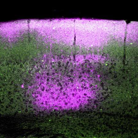 Some neurons target tiny cerebral blood vessel dilation