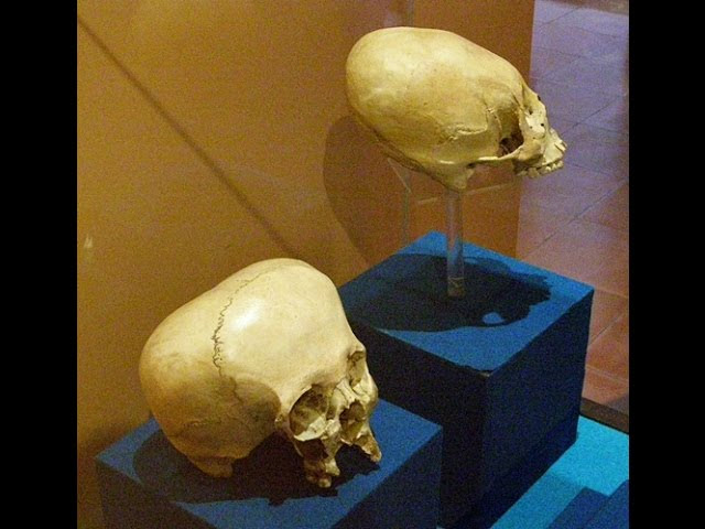 Ancient Elongated Skulls Of Mexico  Sddefault