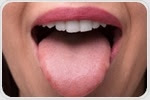 Microbes on the tongue could be used to diagnose pancreatic cancer