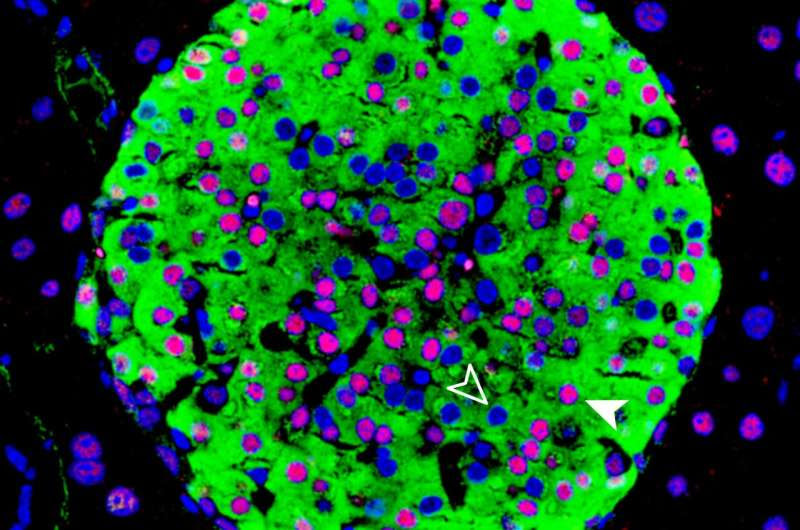 Diabetes-causing gene can be regulated like a rheostat